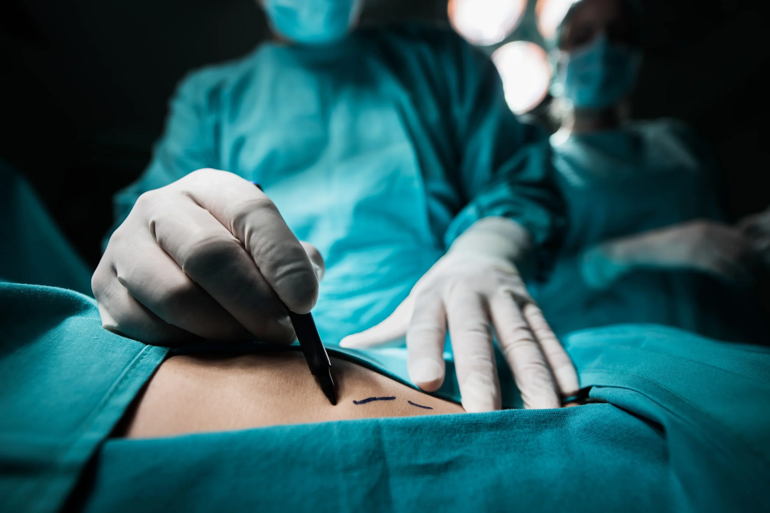 Best Bariatric Surgeon in Delhi