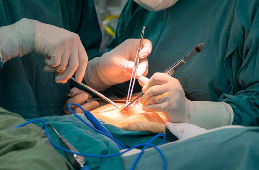Best Colorectal Surgeon in Delhi