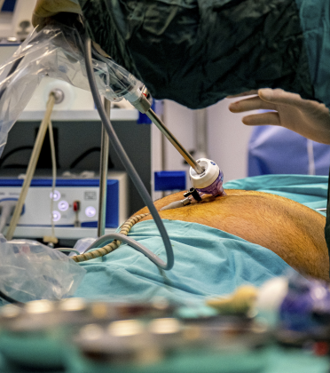 Best Bariatric Revision Surgeon in Delhi