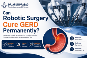 Best GERD Surgery in Delhi