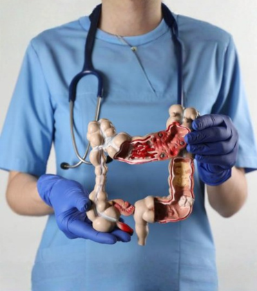 Best Colorectal Cancer Surgeon in Delhi