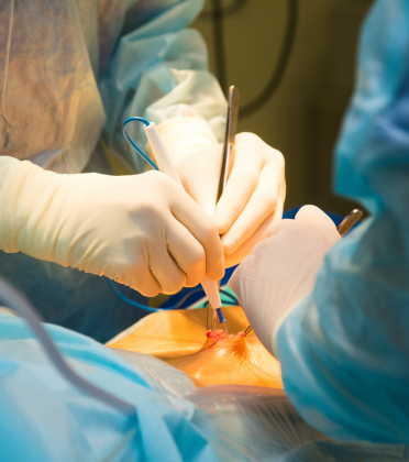 Best Diagnostic Laparoscopy Surgeon in Delhi