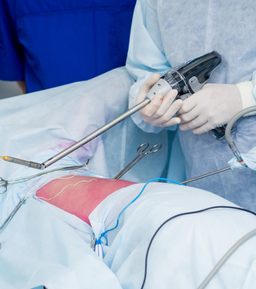 Best GI Tumor Surgeon in Delhi