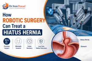 Best Hiatal Hernia Surgeon in Delhi