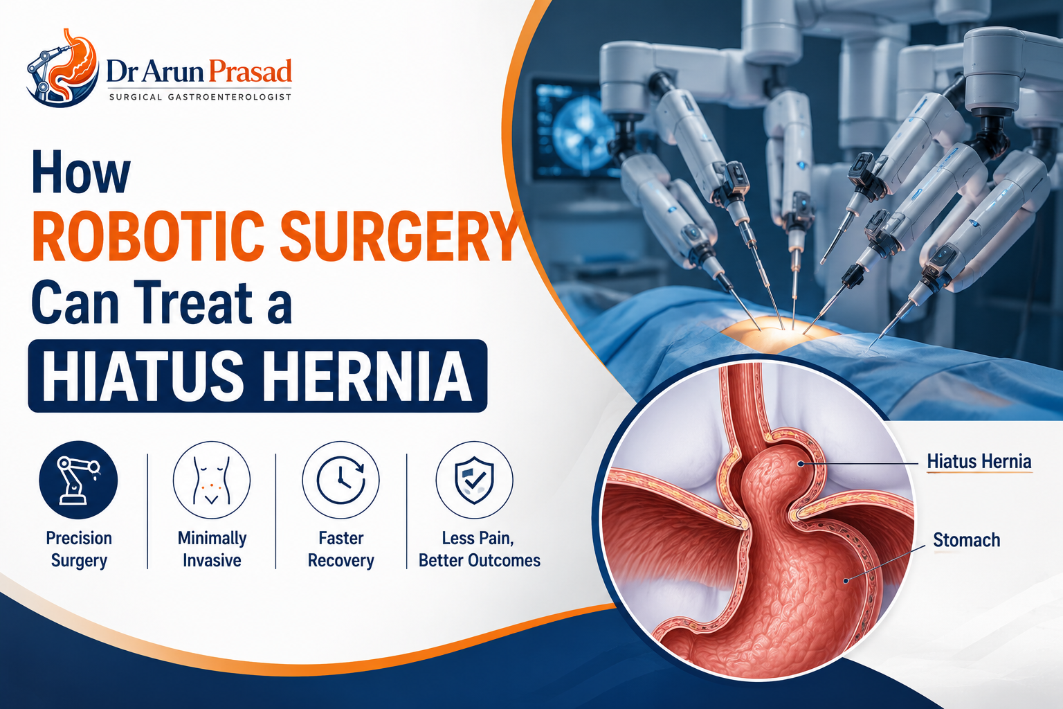 Best Hiatal Hernia Surgeon in Delhi
