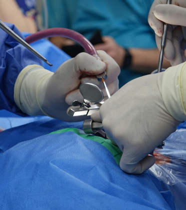 Best Incisional Hernia Surgeon in Delhi