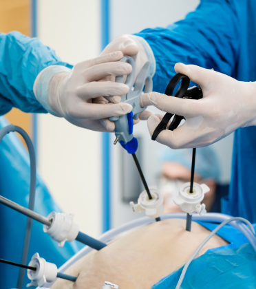 Best Laparoscopic Upper GI Surgeon in Delhi