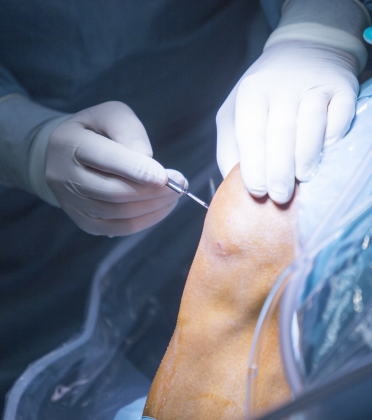 Best Metabolic Surgeon in Delhi