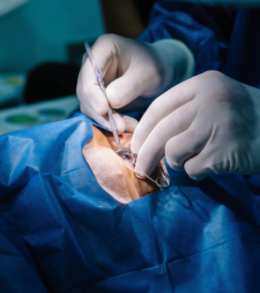 Best Mini Gastric Bypass Surgeon in Delhi