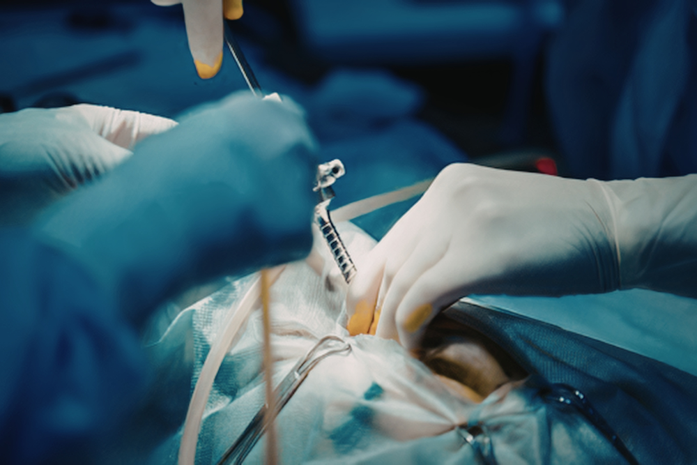 Advanced Minimally Invasive Bariatric Surgery in Delhi