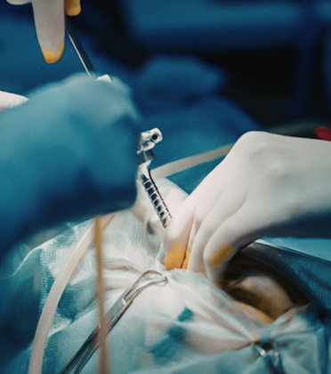 Best Minimally Invasive Cancer Surgeon in Delhi