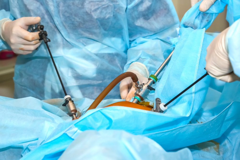 Advanced Minimally Invasive GI Procedures in Delhi