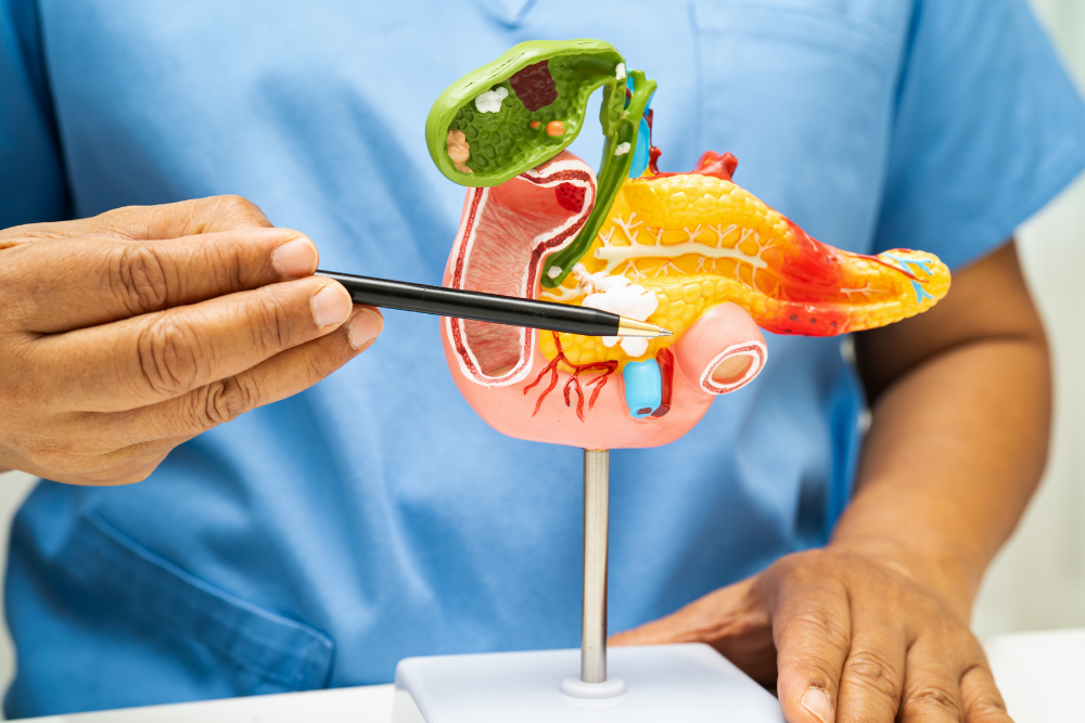 Advanced Pancreatic Cancer Surgery in Delhi