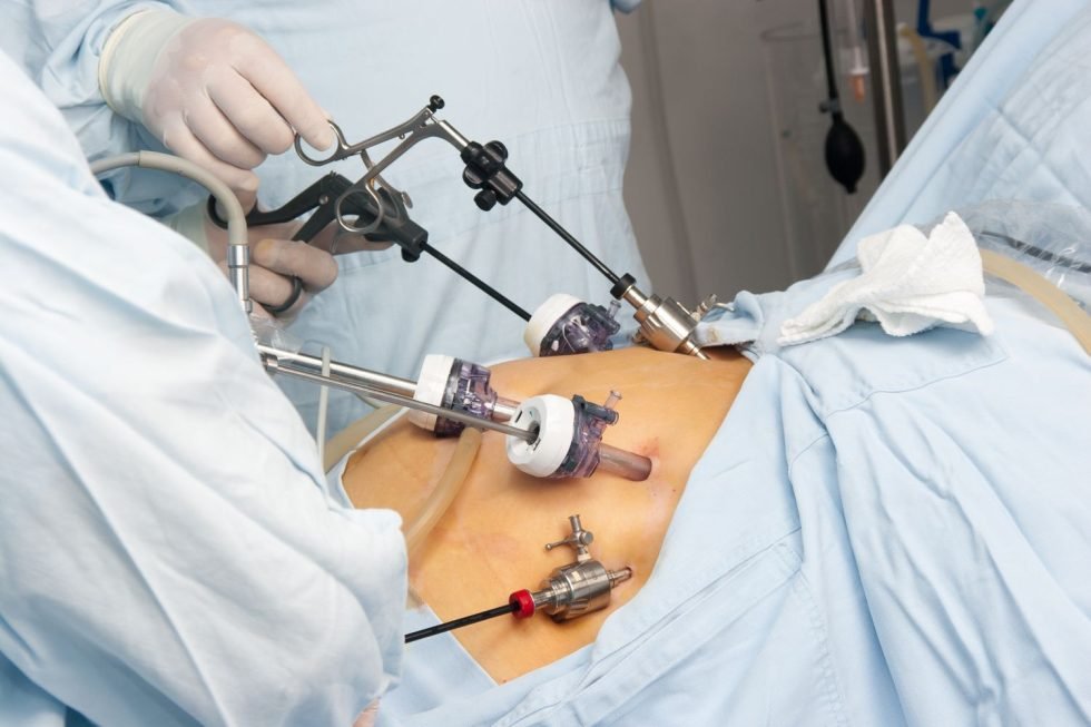 ROBOTIC bariatric-surgery in delhi