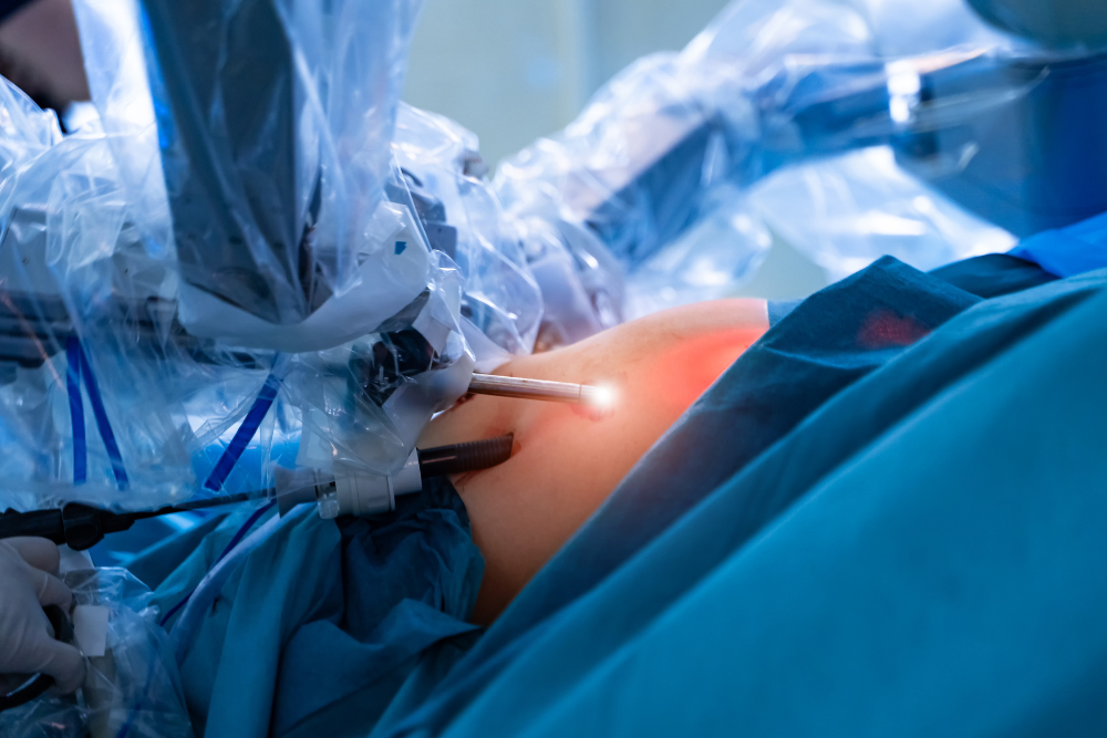 Advanced Robotic GI Cancer Surgery in Delhi