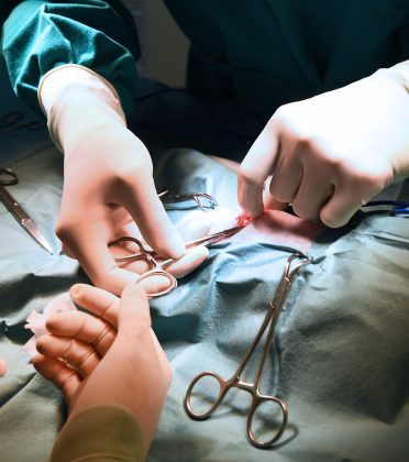 Best Splenectomy Surgeon in Delhi