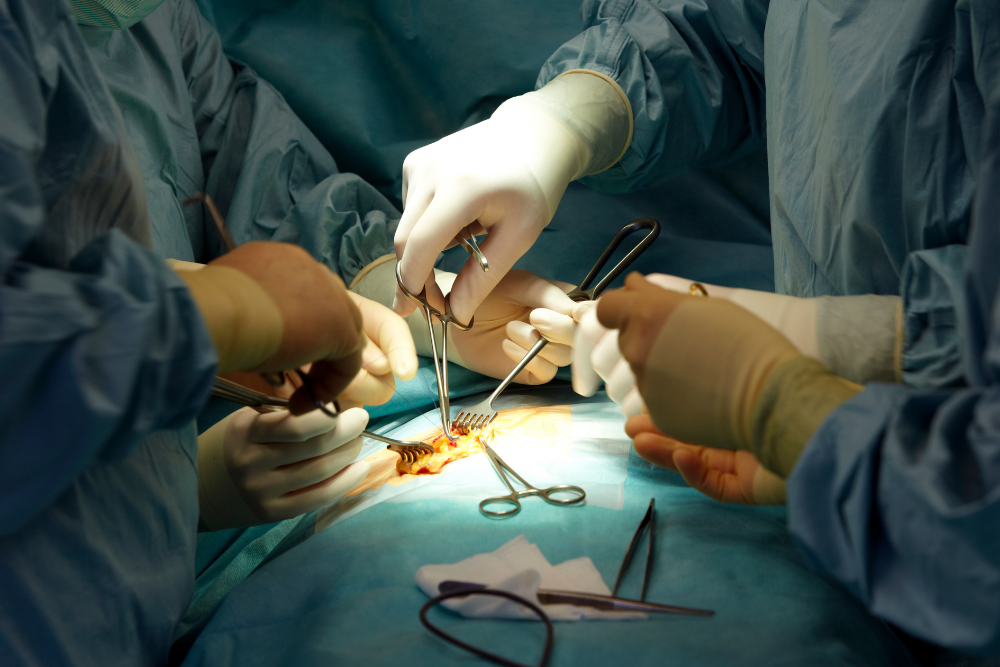 Advanced Splenectomy Surgery in Delhi