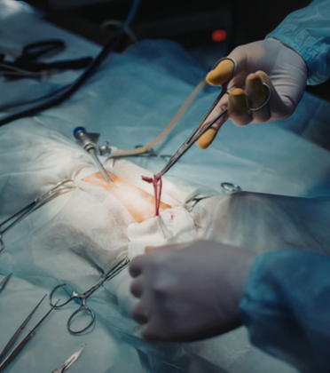 Best Stomach Cancer Surgeon in Delhi