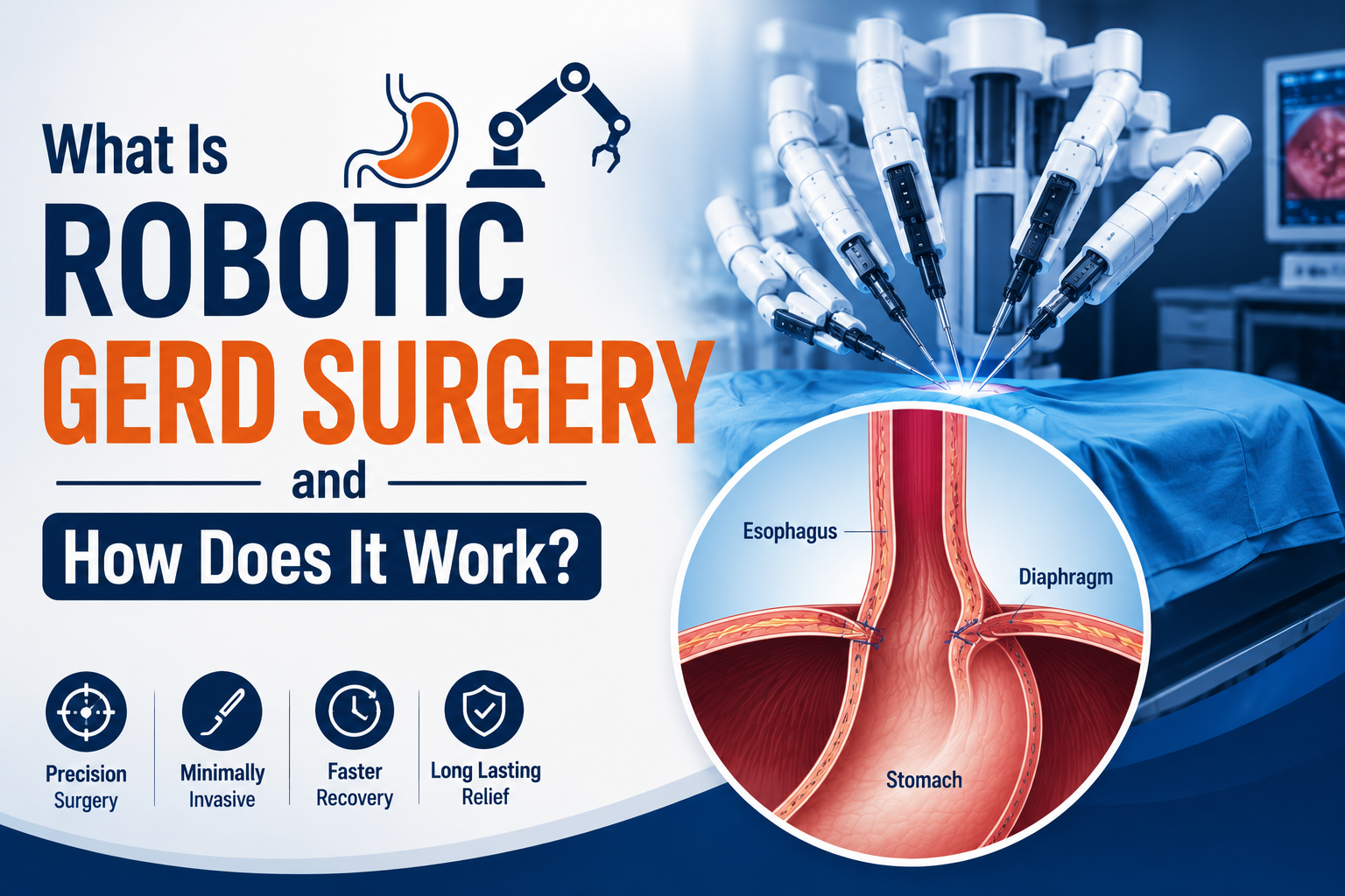 Best GERD Surgery in Delhi