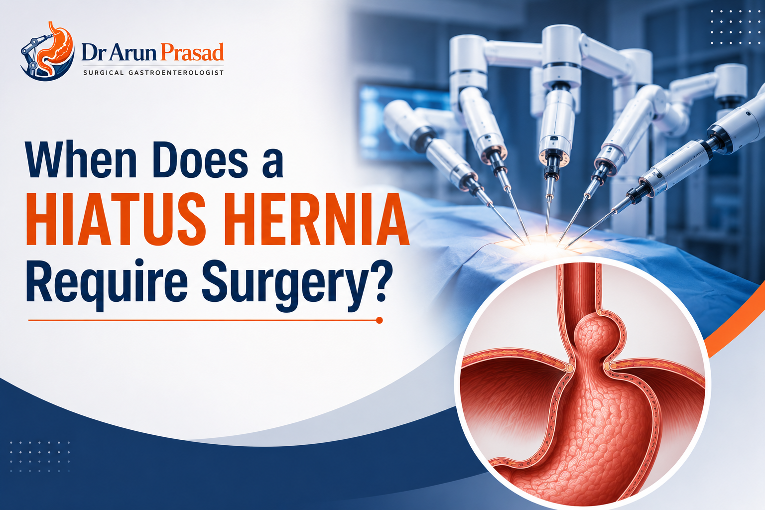 Best Hernia Surgeon in Delh