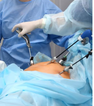 Best Gallbladder Stone Surgeon in Delhi