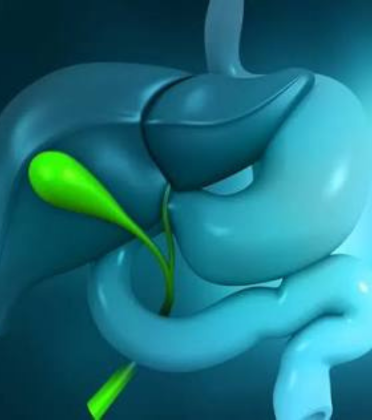 Best Gallbladder Polyp Surgery Surgeon in Delhi