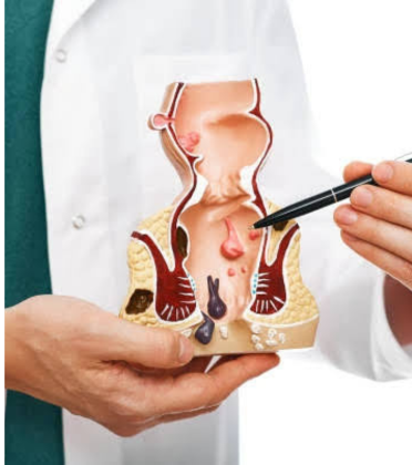 Anal Fissure Treatment by Dr. Arun Prasad