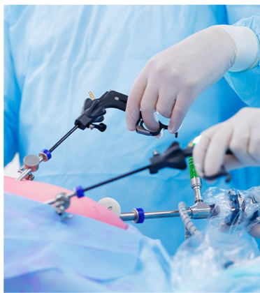 Hemorrhoids Surgery by Dr. Arun Prasad
