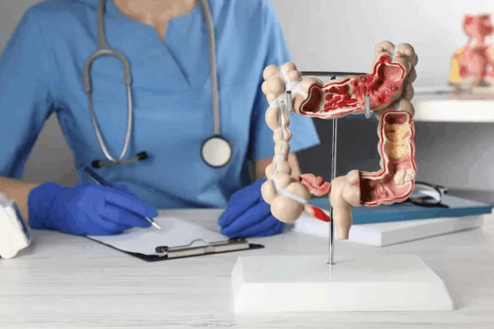 Advanced Colon Surgery in Delhi