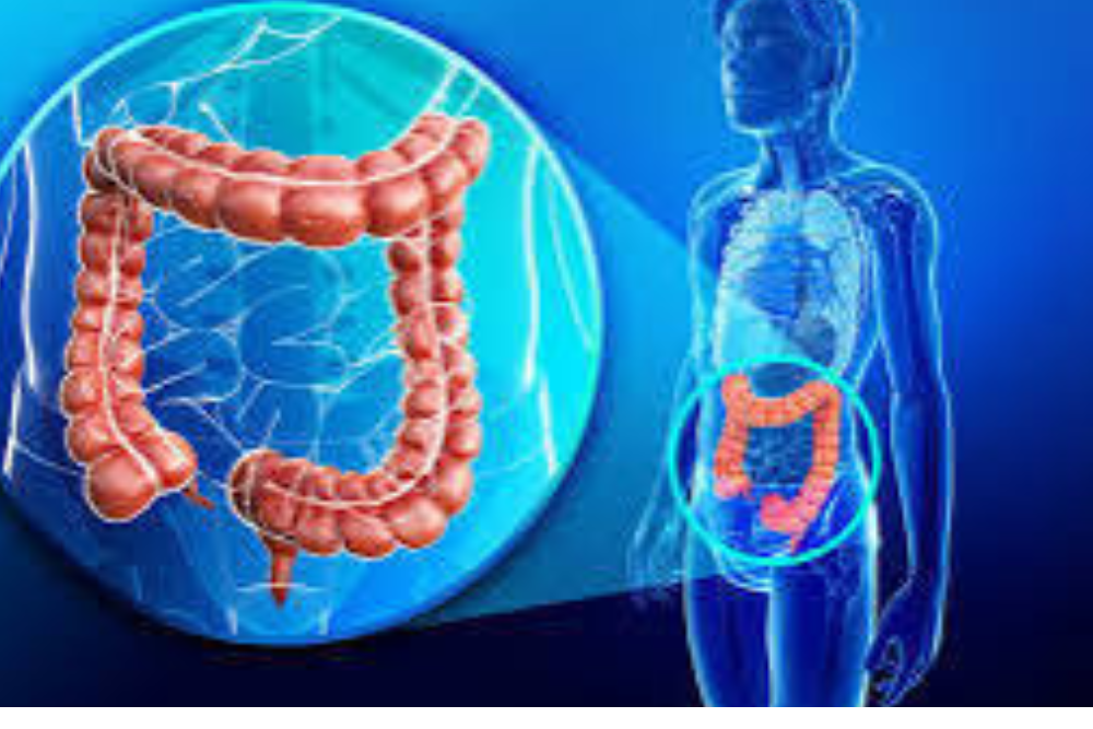 Advanced Colorectal Cancer Surgery in Delhi