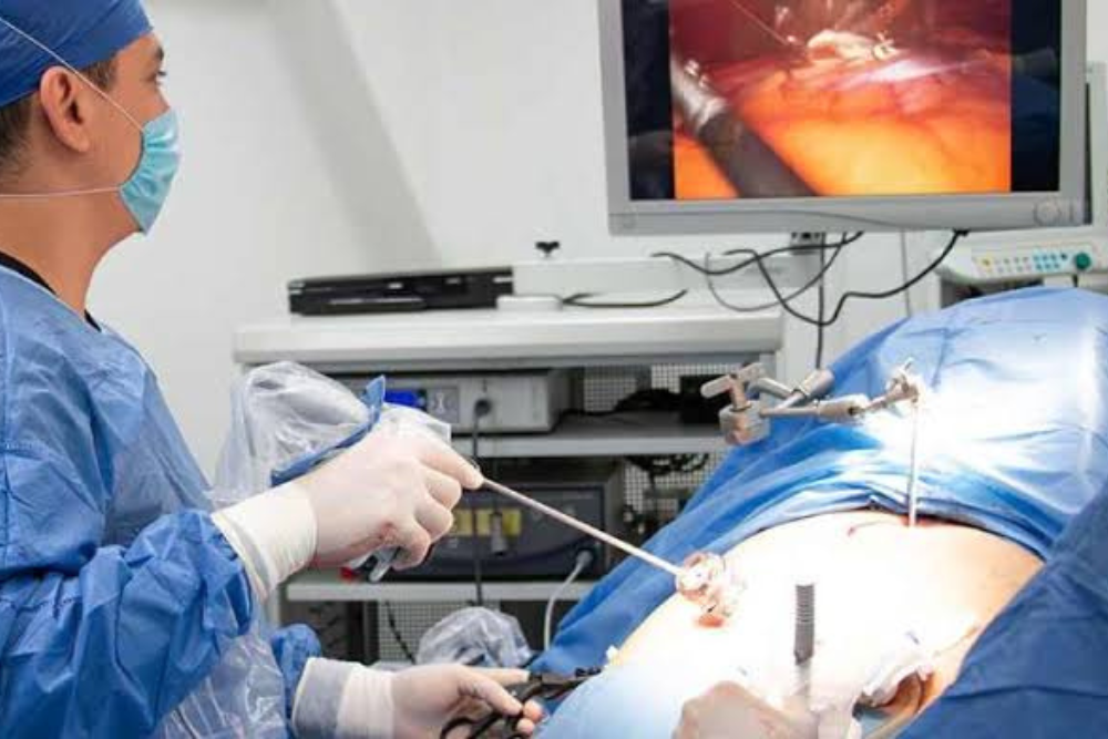 Advanced Anti Reflux Surgery in Delhi