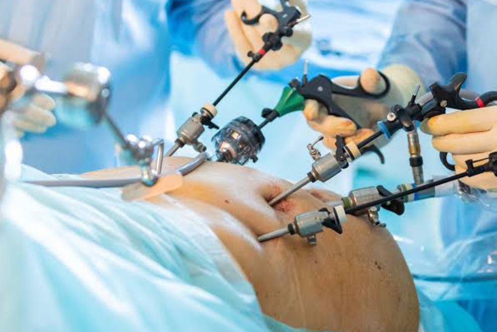 Advanced Liver Surgery in Delhi