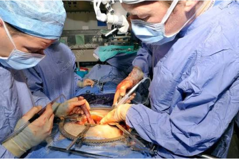 Advanced Whipple Procedure Surgery in Delhi