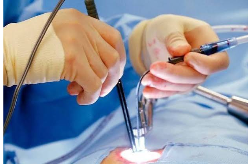 Advanced Laser Proctology Treatment in Delhi