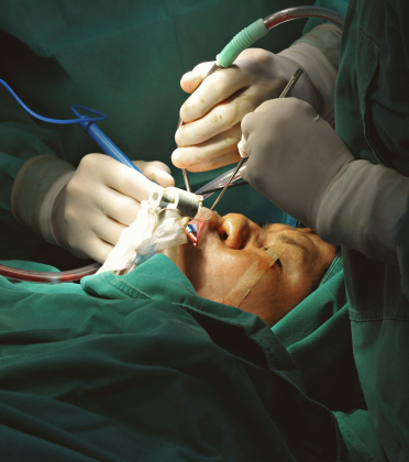 Best Endoscopic GI Surgeon in Delhi